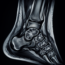 МРТ гомілково-ступневогу суглобу